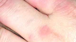 Step mom hand has allergy on step son dick while handjob