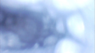Endoscope Lens Captures Unbearable Pleasure