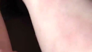 I Show You the Bruises on My Legs After Rough Sex