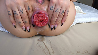My Prolapse Full Exposed - Very Close in 4K