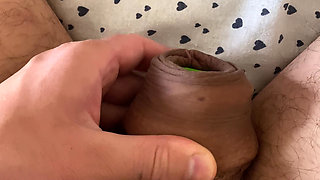 Inflate foreskin stretching