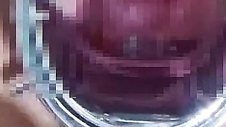 Using a Speculum to Spread an M-woman's Pussy, Anal Training　1/2