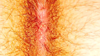 A Butt That Hairy